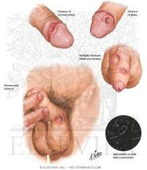 Illustration for article titled Obat Kulup Bengkak